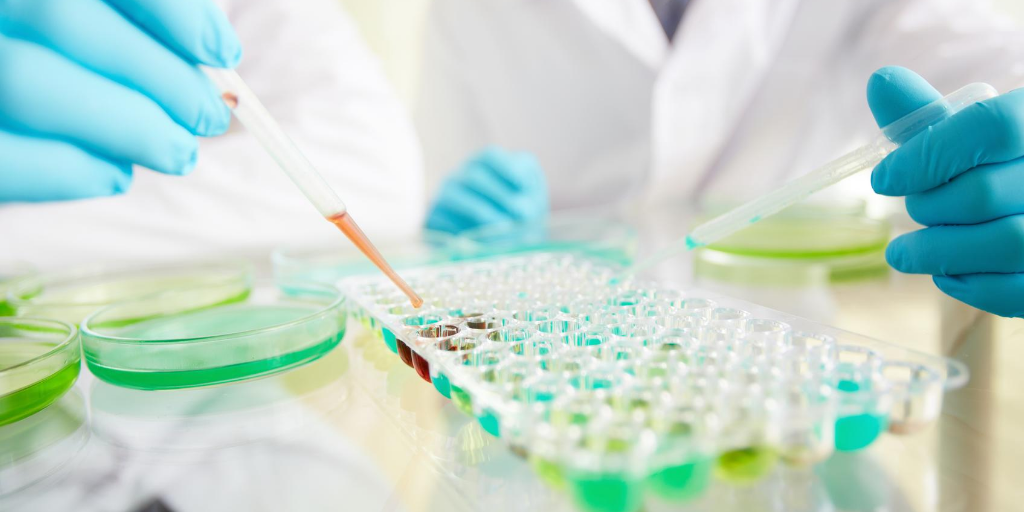 RSCI Researchers show blood test can predict who is likely to develop